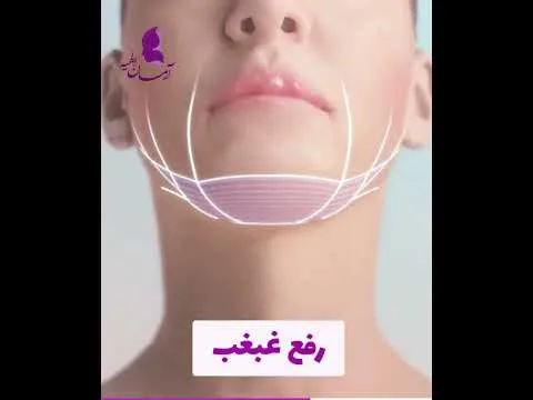 بهترین دکتر هایفو نی نی سایت